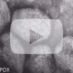 Smallpox virus under microscope
